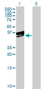 EXOSC3 Antibody in Western Blot (WB)