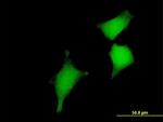 GLRX2 Antibody in Immunocytochemistry (ICC/IF)