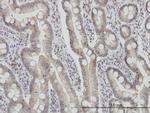 FIS1 Antibody in Immunohistochemistry (Paraffin) (IHC (P))