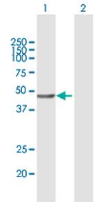 VPS36 Antibody in Western Blot (WB)