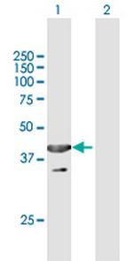 UBXN1 Antibody in Western Blot (WB)