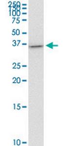 ZBTB7B Antibody in Western Blot (WB)