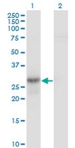 GMNN Antibody in Western Blot (WB)