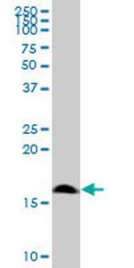 POLR1D Antibody in Western Blot (WB)