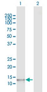 POLR1D Antibody in Western Blot (WB)