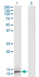 GAL Antibody in Western Blot (WB)