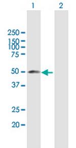 YBX2 Antibody in Western Blot (WB)