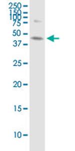 ABHD5 Antibody in Western Blot (WB)