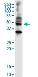 ABHD5 Antibody in Western Blot (WB)