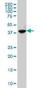 ABHD5 Antibody in Western Blot (WB)