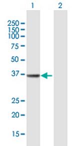 MECR Antibody in Western Blot (WB)