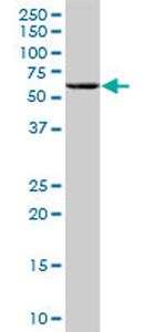 ANGPTL4 Antibody in Western Blot (WB)