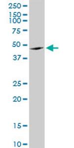 ANGPTL4 Antibody in Western Blot (WB)