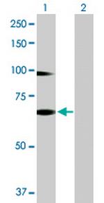 RNF12 Antibody in Western Blot (WB)