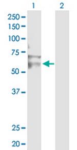 RNF12 Antibody in Western Blot (WB)