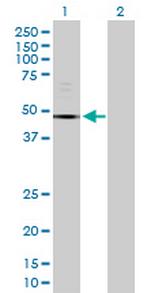 TUBE1 Antibody in Western Blot (WB)