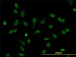 LEF1 Antibody in Immunocytochemistry (ICC/IF)