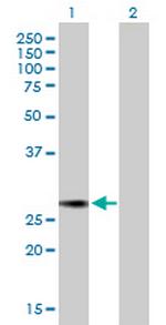 NUSAP1 Antibody in Western Blot (WB)