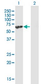 UBAP1 Antibody in Western Blot (WB)