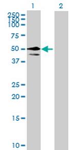 CDC40 Antibody in Western Blot (WB)