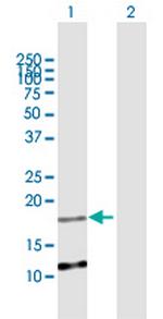 C2orf28 Antibody in Western Blot (WB)