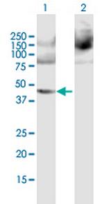 PPME1 Antibody in Western Blot (WB)