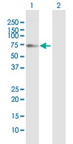 YTHDF2 Antibody in Western Blot (WB)