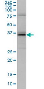 UBE2J1 Antibody in Western Blot (WB)