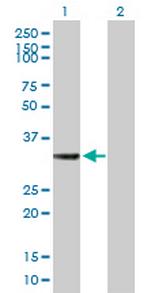 HSD17B7 Antibody in Western Blot (WB)