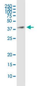 HSD17B7 Antibody in Western Blot (WB)