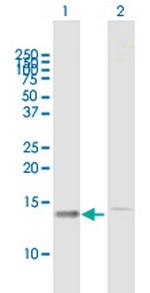 HSPC152 Antibody in Western Blot (WB)