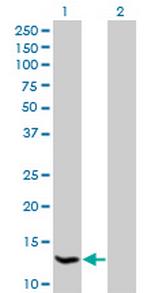 HSPC152 Antibody in Western Blot (WB)