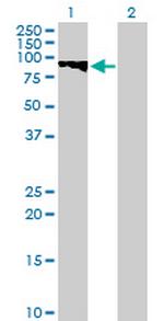 GTSE1 Antibody in Western Blot (WB)