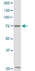 GTSE1 Antibody in Western Blot (WB)