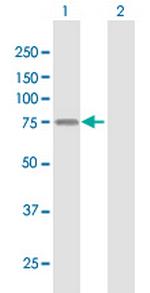 LSR Antibody in Western Blot (WB)