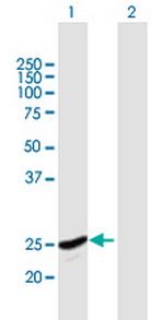 GINS2 Antibody in Western Blot (WB)