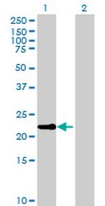 OAZ3 Antibody in Western Blot (WB)