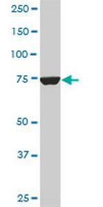 CPSF3 Antibody in Western Blot (WB)