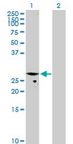 CMPK Antibody in Western Blot (WB)