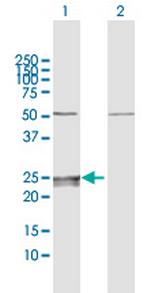 CMPK1 Antibody in Western Blot (WB)