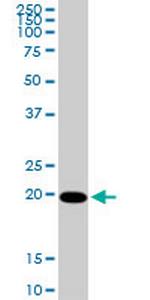 CMPK Antibody in Western Blot (WB)