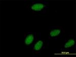 POLR3K Antibody in Immunocytochemistry (ICC/IF)