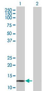 POLR3K Antibody in Western Blot (WB)