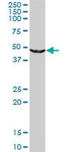 UPB1 Antibody in Western Blot (WB)