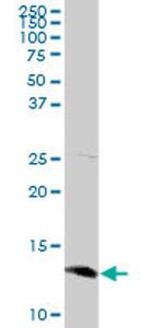 SEPX1 Antibody in Western Blot (WB)