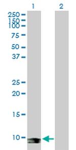 SEPX1 Antibody in Western Blot (WB)