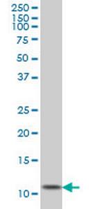 GHRL Antibody in Western Blot (WB)