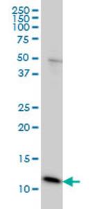 GHRL Antibody in Western Blot (WB)