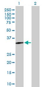 MYOZ2 Antibody in Western Blot (WB)