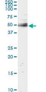 UBASH3A Antibody in Immunoprecipitation (IP)